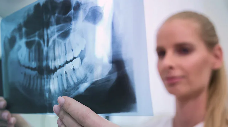 Profesional de CPH Salud revisando una radiografía panorámica dental a contraluz