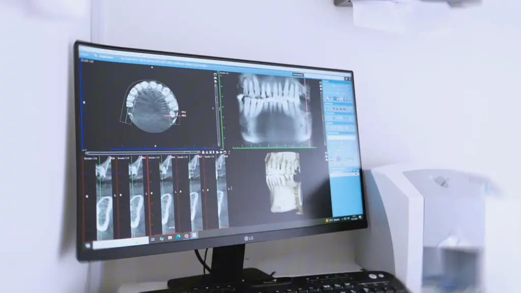 Monitor del box de CPH Salud mostrando radiografías y una reconstrucción 3D de la mandíbula